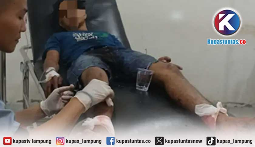 Diserang Tetangga, Pria di Lampung Selatan Alami 20 Luka Bacok di Sekujur Tubuh