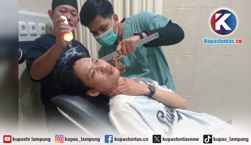 Kasus Pengeroyokan Kenny di Rawa Laut Naik Penyidikan, Pelaku Masih Diburu