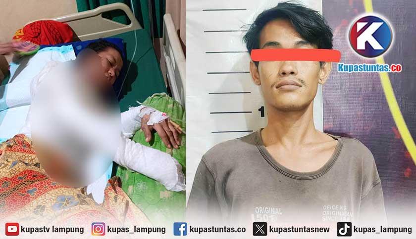 Cemburu Buta, Suami di Metro Lampung Bakar Istri